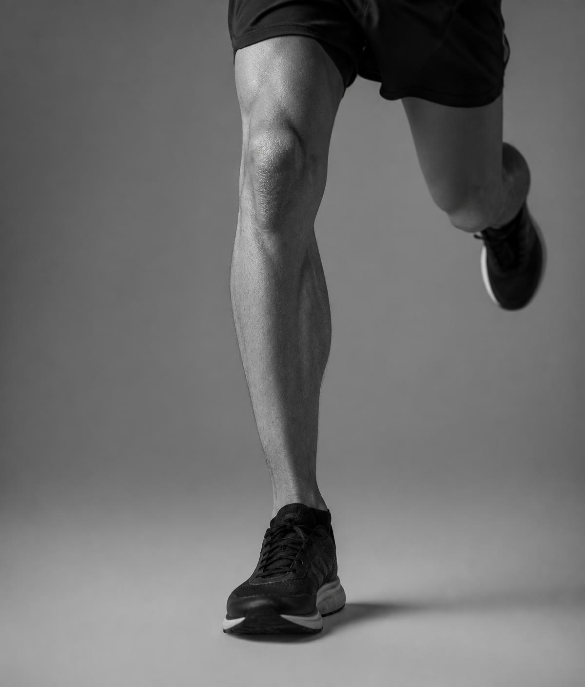 kneescope Kneescope or anterior cruciate ligament (ACL) reconstruction (meniscal tears, ligament rupture)